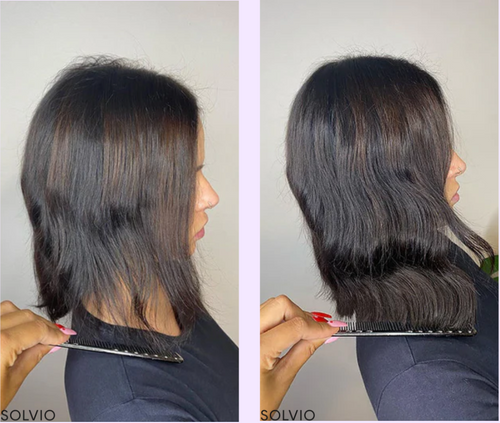 Solvio Hair Growth Accelerator