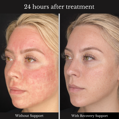 SOLVIO Recovery Serum™