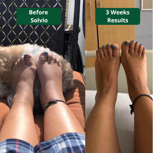 SOLVIO Lymphatic Drainage